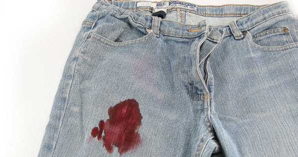 Как отстирать кровь с белой одежды в домашних условиях